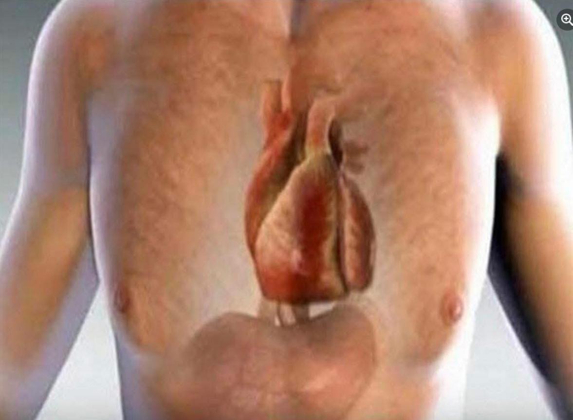 Un infarto te avisa un mes antes: el cuerpo te alerta con 6 señales ...
